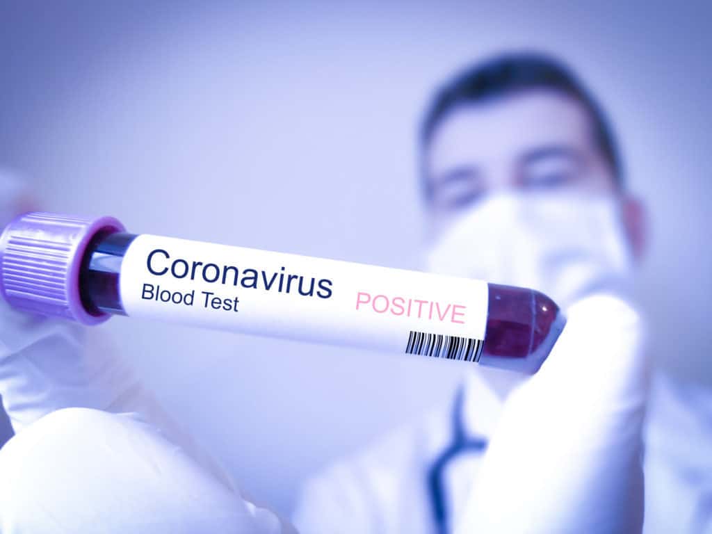 Distanțare socială din cauza coronavirusului